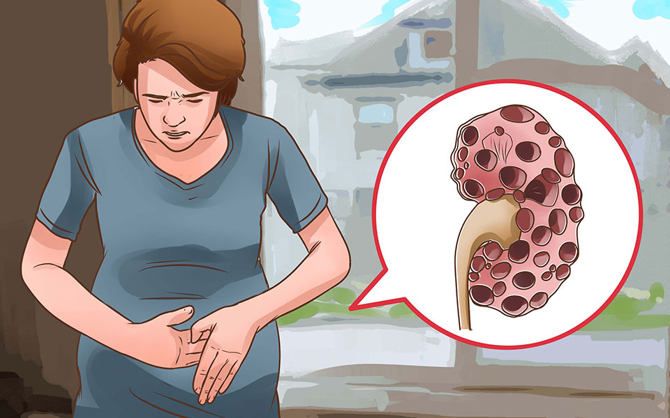 How to Prevent Kidney Disease